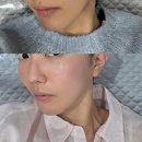 셀비전 쎄라쥬 사용 대망의 10주차 찐 후기 (최저가 할인코드 공유까지?!!)