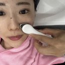 뷰티다룸천안 | 천안 백석동 피부관리 뷰티다룸 여드름압출 물방울리프팅 후기