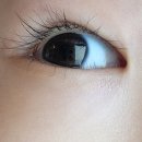양산밝은안과의원 네이버블로그