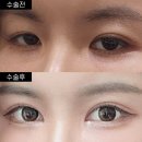 일퍼센트성형외과의원 이미지