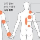 오른쪽 등 통증 원인 옆구리 날개뼈 갈비뼈 이미지