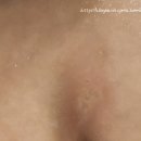 1번약국 | 동래봉생병원 갑작스러운 아이 알레르기 진료 + 바디리포트(내몸나이) 측정후기
