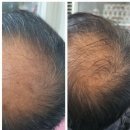 영화바이오핵산 | 몸도 노화를 방지 할 수 있는 핵심은 텔로미어 영양제 먹고 에센스 바르기만 하면 끝이였던 강추 후기