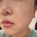 기미잡티크림 찾는다면? &lt;닥터브린셀 스템셀 골드크림&gt; 무료체험 리얼 후기!