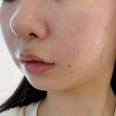 산마루로 | 갈매동에스테틱 벨로셀 에스테틱 크레이지 고주파, 피부 나이 리즈 갱신하고 온 솔직 후기