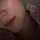 리건치과 발치 후기 내돈내산ㅠ ㅠ