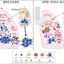 체했을 때 증상 정확한 원인이 무엇일까 이미지