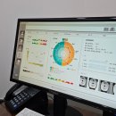 모드라인 | 압구정 튠모드(튠페이스+인모드) 대만족 후기! 라인 정리 최고!
