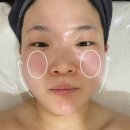 순환동로 | 예비신부 웨딩관리 배곧윤곽 본에스테틱 후기