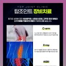 탑조인트의원 이미지