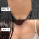 탑태닝 | 잠실 화이트태닝 예신 후기｜톤업 효과 제대로 본 네오라태닝 잠실점