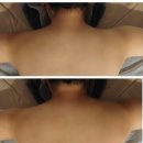 EMS 림프순환 테라피 의정부통증관리 의정부 대단한몸매 행복로점 / 목 어깨 통증 개선 후기