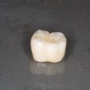 민치과기공소 이미지