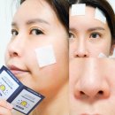 메디사이언스 | 올리브영 여드름패치 추천 피지관리&amp;얼굴에 좁쌀여드름 없애는법 2주 후기
