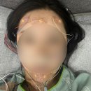 부산 수면유지장애로 수면다원검사받고 온 후기 및 경과