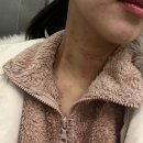 편평사마귀 제거 후 관리 방법, 레이저 대신 강서목동 한의원 거우침 선택 이유 가격