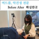 도파눈썹