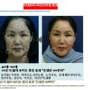 청담미의원 | 리프팅전문 청담미네르바