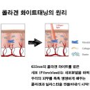송도피부관리 에스떼리밋 이미지