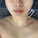 [하남]미사피부관리 고민 끝, 고원장의모공세척테라피 초음파수분채움리프팅 후기