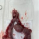 친구가 될 동물병원 | 다산신도시 &#39;친구가 될 동물병원&#39; 에서 우리 강아지 자궁축농증 수술하다