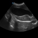 엔도소노 이미지