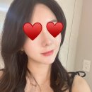 하늘도시피부과 영종도피부과 즉각효과 써니리프팅후기