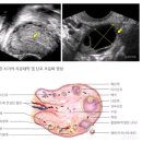 배란통 증상 정확한배란일계산기는 내 몸이죠! 이미지