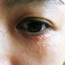 에이치봄의원 이미지