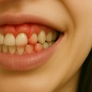 조한약국 | 잇몸 염증 약, 2주 만에 통증 -80% 감소한 비결