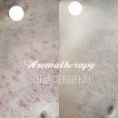 참사랑세탁소 | 항암부작용관리 피부염증관리 도원동아로마테라피 ::김민주피부샵 후기