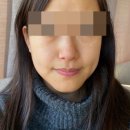 참튼튼약국 | 멜라닌 크림 약국 처방 사용 후기 +루틴 소개