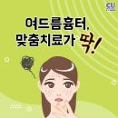 여드름흉터, 흉터 종류와 형태 따른 맞춤치료가 필요! 이미지