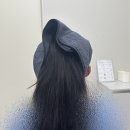 귀일지 | 천안 피부과 통증 1도없던 귀필러 내돈내산후기