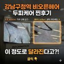 강남구청역 미용실 비오른헤어 두피케어 후기