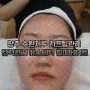 광산구-145 | 광주 수완지구 리프팅관리 탄력관리 에스테틱 펄미에이트