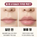 고은미의원 | 동탄입술필러 용량, 몇 cc가 적당할까