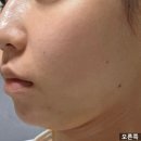 이다모드 | 홈모드 3주차 신부관리 홈모드써마리프트 내돈내산 홈모드후기