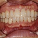 M치과기공소 이미지