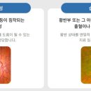 새봄안과