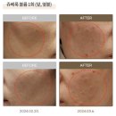 반포쇼팅타운 7동 앞 | 반포 피부과 쥬베룩 후기, 제대로 만족하려면