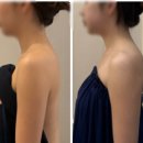 내리길 | [Wedding] 대전 유성구 원신흥동 예신 라인 승모내리기 장인 내돈내산 재방문 후기 - 리랩 ..ෆ