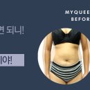 마이퀸의원 네이버블로그