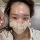 이담헤어 - 부천시 소사구 안곡로 13 | [잠실역 이담] 헤어라인 SMP 2회차 후기