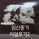 31140-8-23-13 | 임신중기 리얼후기2 (아인병원 임당검사, 입체초음파)