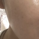 아젤리아 | 아젤리아크림 부작용 효과 내돈내산 후기