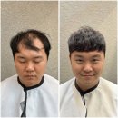 블랭크헤어룸 | 숱없는 남자 펌이랑 남자붙임머리로 해결 대구에서 블랭크유 미금까지 오는 이유