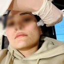 한빛나노멀티케어침대 | 반포 피부과 피코토닝 9회차 엑셀브이 피코레이저 꿀광 부스터 후기