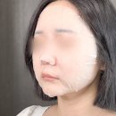 레텐마이어코리아(주) | 색소침착 크림 셀폰즈 레가토닝 홈케어 4주 기미 개선 효과