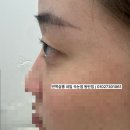 동탄산단5길L | 동탄속눈썹펌 후기로 인증하는 무쌍속눈썹펌 맛집 (+무쌍속눈썹펌도 가능할까?)